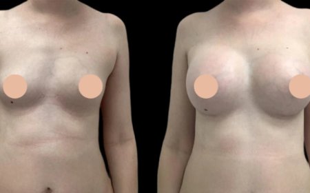 Dubai’s Hidden Gems: Best Breast Augmentation Surgeons You Haven’t Heard Of