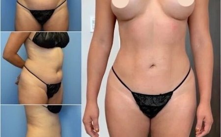 How Body Contouring in Dubai Can Transform Your Look