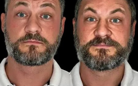 Embrace Renewal with the Best Doctors in dubai Profhilo Touch