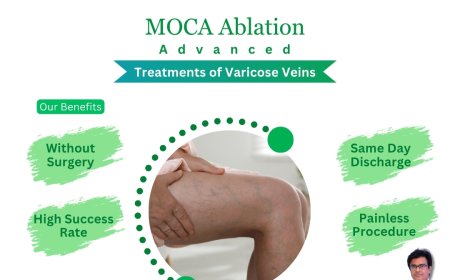 Stop Hiding Your Legs: Discover India’s Top Choice for Varicose Vein Treatment