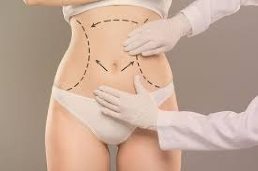 Why Choose the Best Doctors in Dubai for Your Fat Transfer Procedure