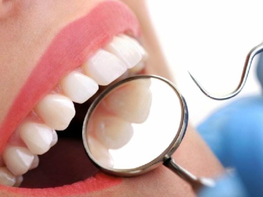 The Art of Carving: How Dental Carvers Shape Perfect Smiles