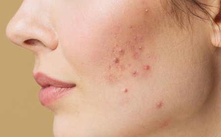 Transform Your Skin: Trusted Solutions for Acne Scars, Eczema & Alopecia Treatment