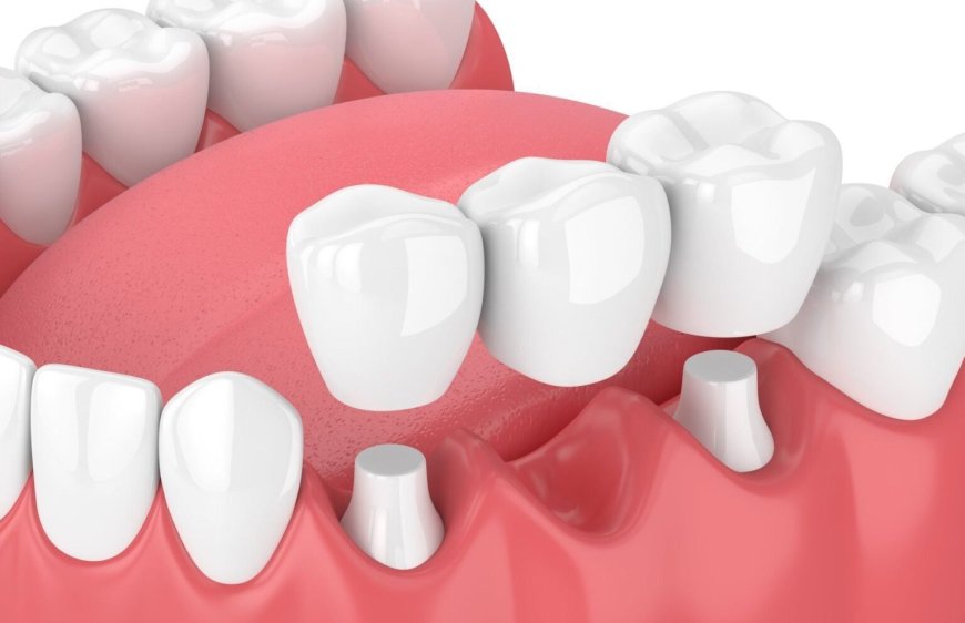 Hoe kies je de juiste tandarts praktijk in Breda?